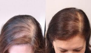 Biotin Hair Growth Essence Spray (Buy 1 Get 1 FREE) photo review