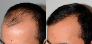 Biotin Hair Growth Essence Spray (Buy 1 Get 1 FREE) photo review