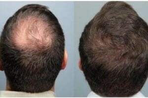 Biotin Hair Growth Essence Spray (Buy 1 Get 1 FREE) photo review